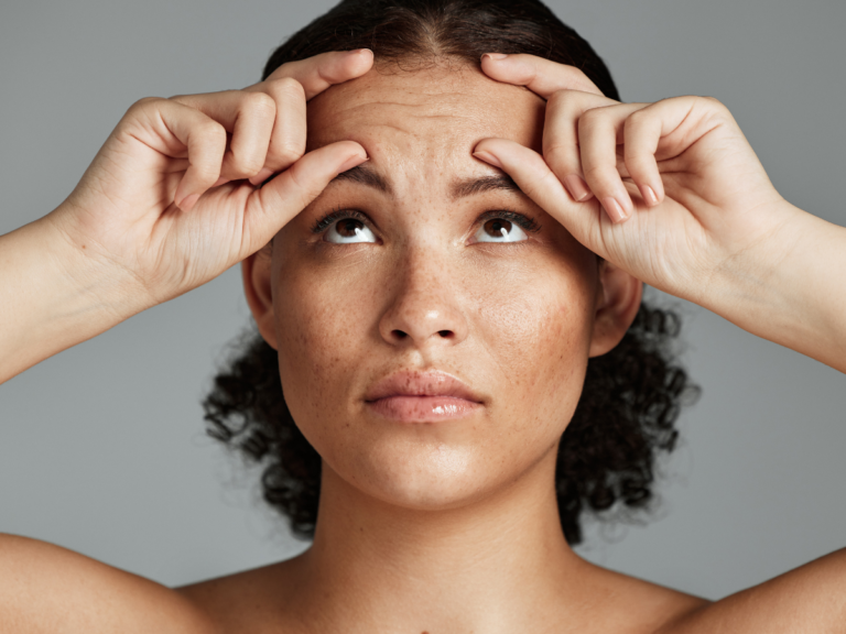 Get Rid Of Forehead Wrinkles: 10 Essential Tips For Women In Their 30s